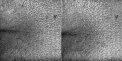 經(jīng)臨床驗證的結(jié)果